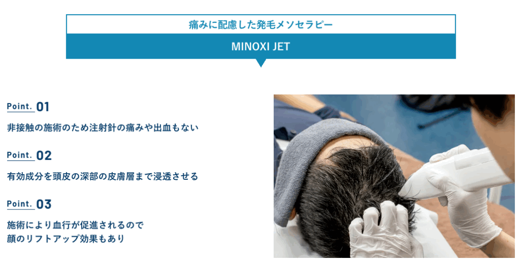 AGAスキンクリニックのMINOXIJETに関する画像