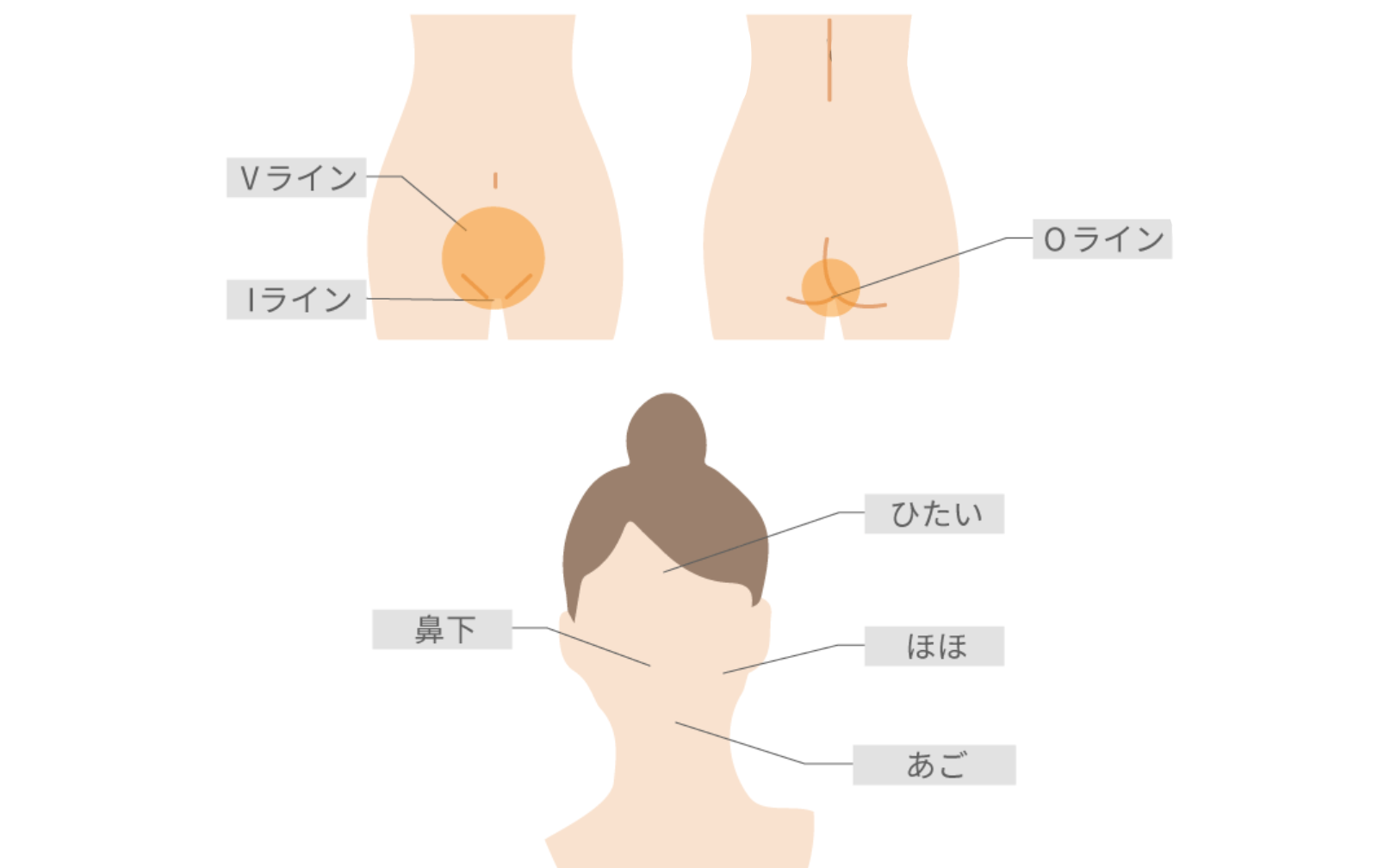 全身+顔+VIOの脱毛範囲は顔とVIOを含む全身