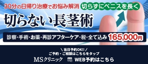 MSクリニックの長茎術・切らない長茎術に関するイラスト画像