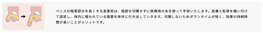 アトムクリニックの長茎術に関するイラスト画像