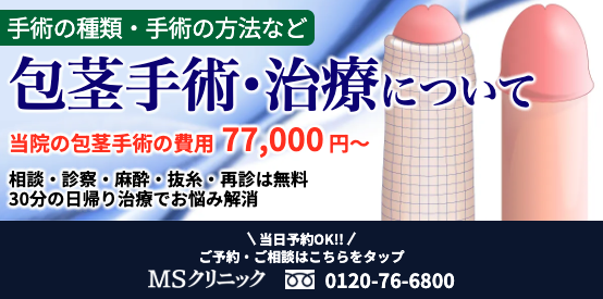 MSクリニックの包茎手術の詳細に関する画像