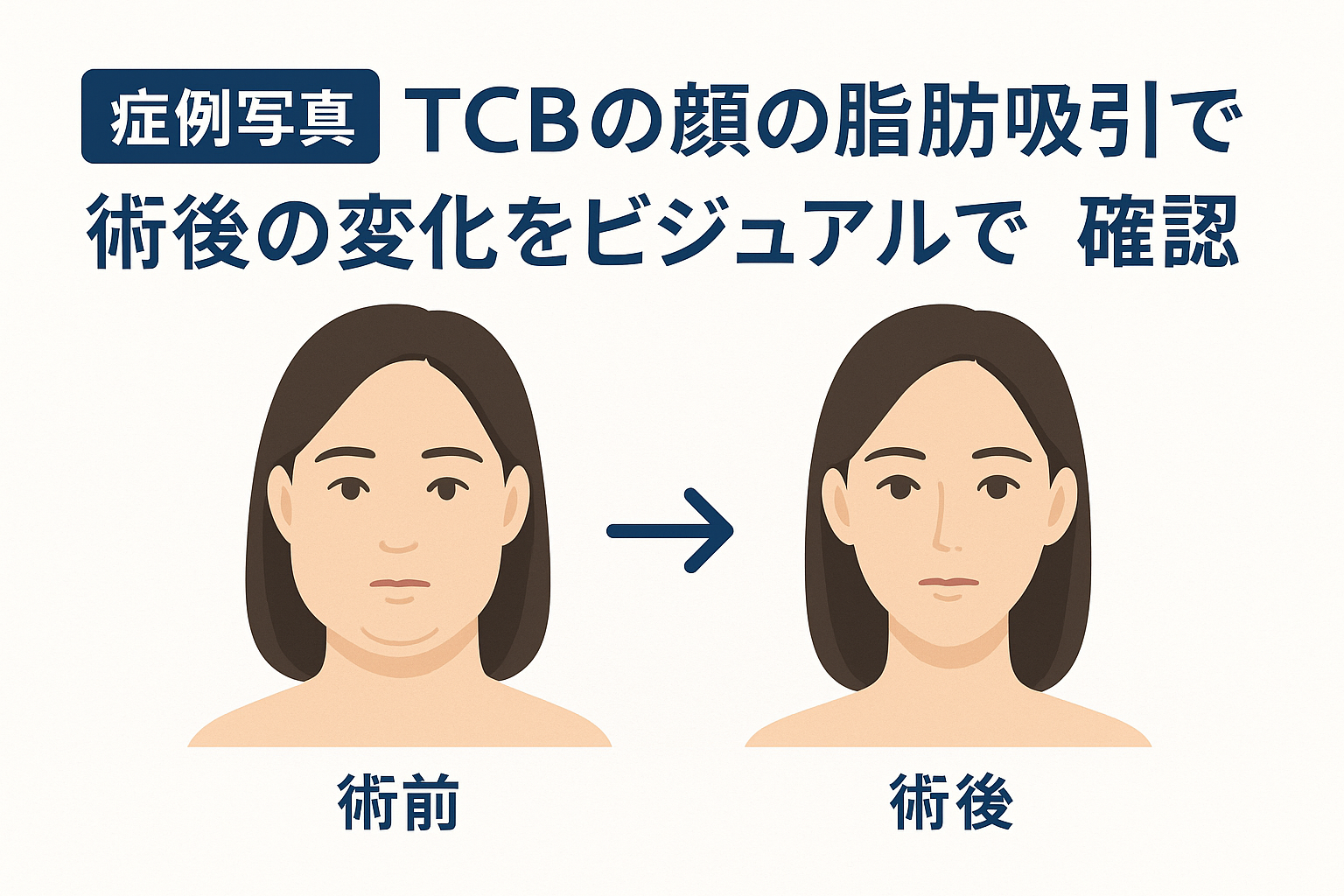 【症例写真】TCBの顔の脂肪吸引で術後の変化をビジュアルで確認