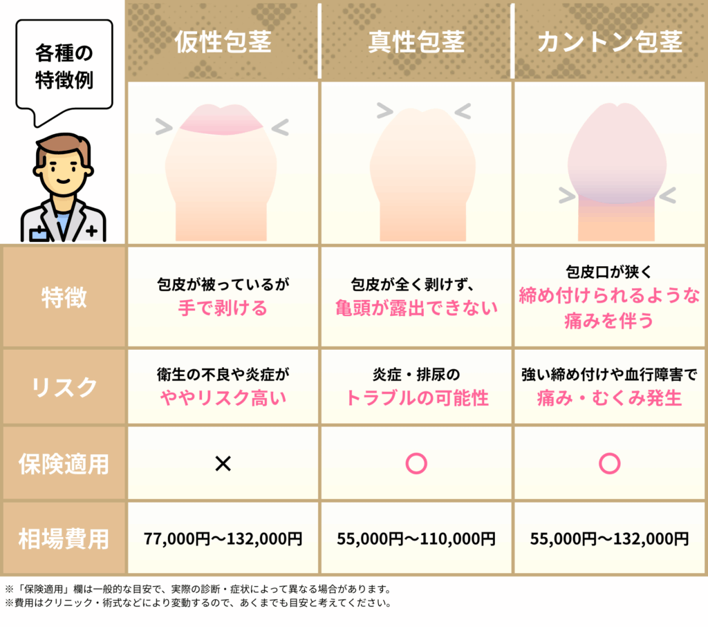 包茎の種類とそのリスクや特徴・相場費用をまとめたイラスト画像