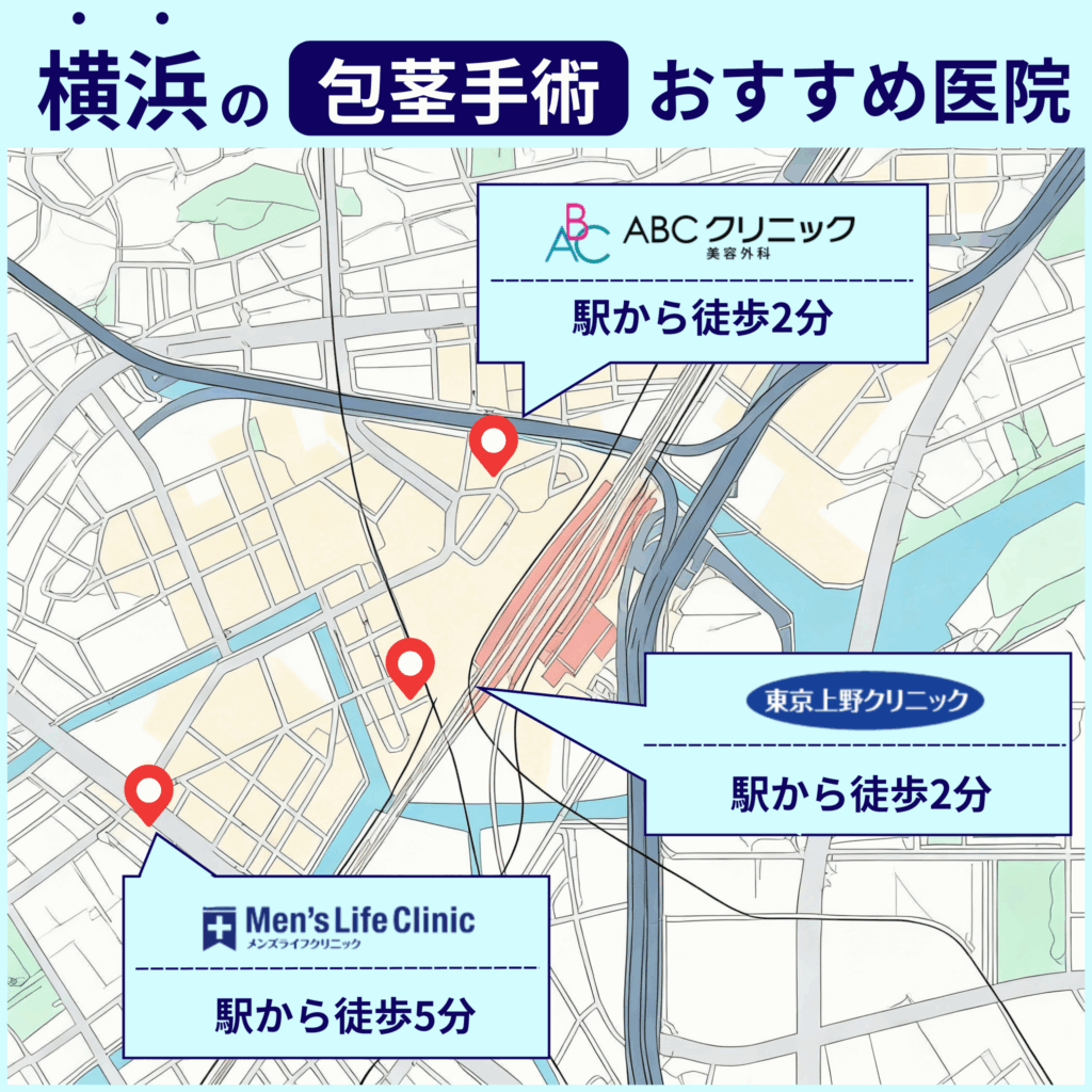 【厳選】横浜で包茎手術がおすすめ・安心・安いクリニックをイラストマップで確認