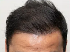 1年1ヶ月後年後